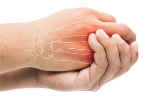 treatment for parkinson's disease, powerball, powerball autostart